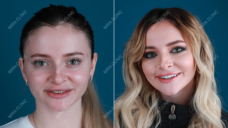 More Than Beautiful Teeth